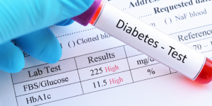 Diabetes Test - Katy TX Mason Park Medical Clinic