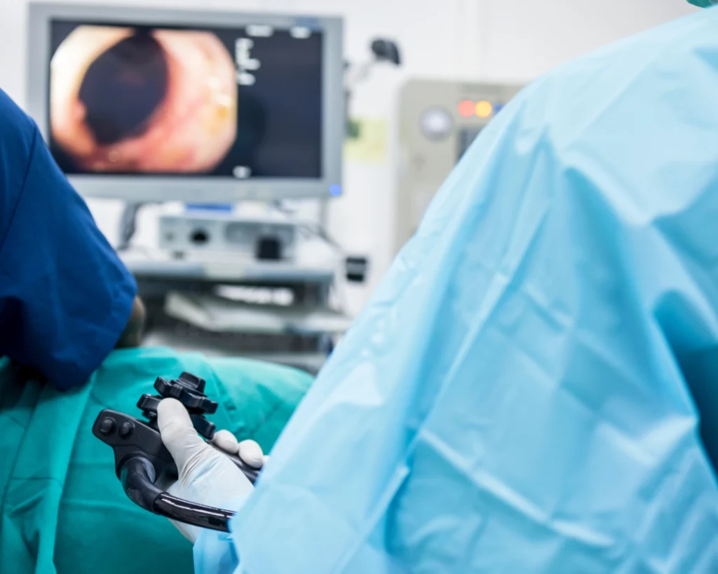 A doctor performing a colonoscopy to screen for colorectal cancer.